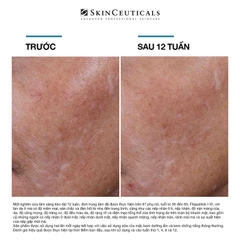 SKINCEUTICALS H.A. INTENSIFIER MULTI GLYCAN / TINH CHẤT CHUYÊN BIỆT GIÚP DA CĂNG MỊN, ẨM MƯỢT VÀ SĂN CHẮC