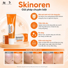 Skinoren Acidum Azelaicum: Kem Trị Mụn, Mờ Thâm & Điều Trị Rosacea Chuyên Sâu