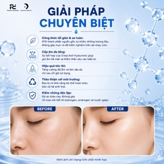 SVR [B3] Ampoule Hydra: Tinh Chất Phục Hồi, Cấp Ẩm Và Chống Lão Hóa Chuyên Sâu