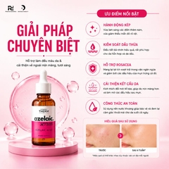 Synergy Therm 10% Azelaic Acid Serum: Tinh Chất Giảm Mụn, Mờ Thâm Và Phục Hồi Da Đỏ