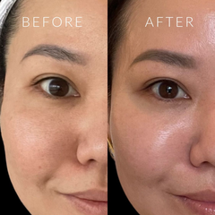 TRỊ LIỆU CHUYÊN SÂU GLOW-UP: Giải Pháp Toàn Diện Cho Làn Da Đô Thị