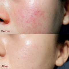 DR.DIFFERENT CICA METAL SERUM / SERUM LÀM DỊU, TĂNG CƯỜNG ĐỀ KHÁNG, PHỤC HỒI LÀN DA