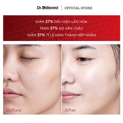 Dr.Different CEQ Anti-Oxidant Serum – Tinh Chất Phức Hợp Vitamin C 15%, E Và CoQ10 Hỗ Trợ Dưỡng Sáng, Làm Mờ Thâm Sạm Và Tăng Độ Đàn Hồi