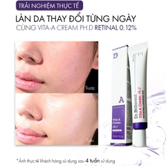 DR.DIFFERENT VITA A CREAM PH.D / KEM DƯỠNG CHỐNG LÃO HÓA, CẢI THIỆN NẾP NHĂN, GIẢM CHẠY XỆ (RETINAL 0.12%)