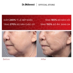 DR.DIFFERENT VITALIFT – A FORTE / KEM DƯỠNG CHỐNG LÃO HÓA, MỜ NẾP NHĂN, TĂNG ĐỘ ĐÀN HỒI, GIẢM CHẠY XỆ