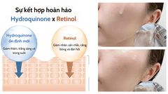 AMPLEUR LUMINOUS HQ BOOSTER / SERUM TRẮNG SÁNG TRỊ NÁM