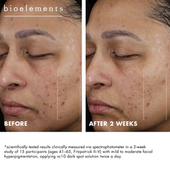 Bioelements VC10 Dark Spot Solution – Kem chấm Vitamin C 10% hỗ trợ cải thiện đốm nâu và tăng sắc tố