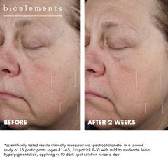 Bioelements VC10 Dark Spot Solution – Kem chấm Vitamin C 10% hỗ trợ cải thiện đốm nâu và tăng sắc tố