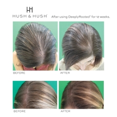 HUSH & HUSH DeeplyRooted/ VIÊN UỐNG ĐẸP TÓC VÀ GIÚP TĂNG TRƯỞNG MỌC TÓC