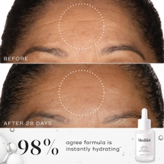 MEDIK8 LIQUID PEPTIDES 30% COMPLEX MULTI-PEPTIDE SERUM / HUYẾT THANH CHỐNG LÃO HOÁ 