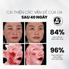 MDCARE NMF PREBIOTICS SERUM REFINED IMPROVEMENT FORMULA / SERUM CÂN BẰNG LỢI KHUẨN, PHỤC HỒI HÀNG RÀO BẢO VỆ DA 