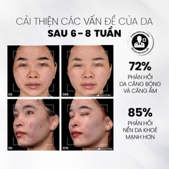 MDCARE GLOW EXFO / TẨY TẾ BÀO CHẾT LÀM SÁNG, MỜ THÂM VÀ ĐỀU MÀU DA 