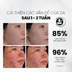 MDCARE COPPER PEPTIDE SERUM ADVANCED IMPROVEMENT FORMULA / SERUM CHỐNG LÃO HOÁ, KÍCH THÍCH TĂNG SINH COLLAGEN - LÀM ĐẦY SẸO 