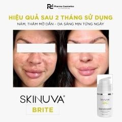 SKINUVA BRITE: Giải Pháp Toàn Diện Cho Làn Da Sáng Khỏe Rạng Rỡ