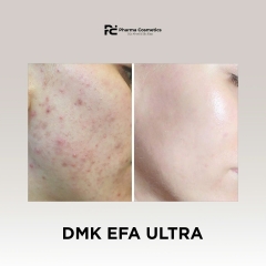 DMK EFA ULTRA: Hỗ Trợ Đẹp Da & Cân Bằng Nội Tiết Từ Bên Trong