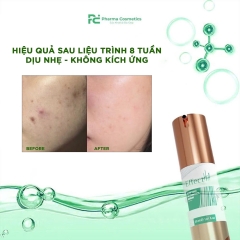 EFFECTHA PURIFYING AC CONTROL SERUM: Huyết Thanh Thanh Lọc & Kiểm Soát Mụn Hiệu Quả Cho Làn Da Sáng Khỏe