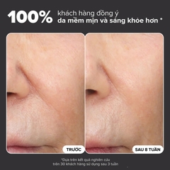 PAULA’S CHOICE SKIN PERFECTING 6% MANDELIC ACID + 2% LACTIC ACID LIQUID EXFOLIANT: Tái Tạo Làn Da Mềm Mịn & Rạng Rỡ