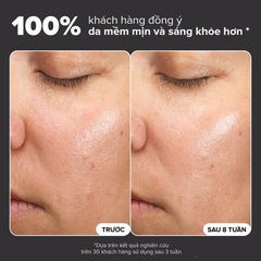 PAULA’S CHOICE SKIN PERFECTING 6% MANDELIC ACID + 2% LACTIC ACID LIQUID EXFOLIANT: Tái Tạo Làn Da Mềm Mịn & Rạng Rỡ