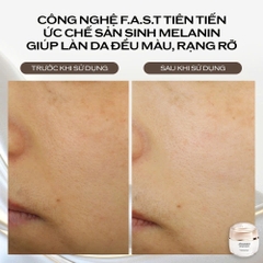 SHISEIDO BENEFIANCE BRIGHTENING GEL CREAM: Gel Dưỡng Trắng Sáng, Cải Thiện Da Không Đều Màu