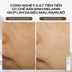 SHISEIDO BRIGHTENING MICRO-SPOT SERUM: Tinh Chất Làm Sáng Da, Mờ Đốm Nâu & Cải Thiện Tông Màu Da