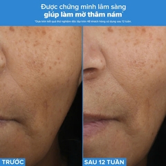 PAULA'S CHOICE RESIST TRIPLE ACTIVE TOTAL REPAIR SERUM: Tinh chất 3 tác động chống lão hóa, mờ thâm nám, giảm nếp nhăn và săn chắc da