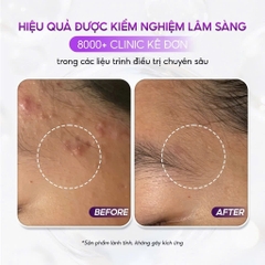 CONAPIDIL FIXICA 13g: Gel Dưỡng & Phục Hồi Da Sau Mụn & Sau Liệu Trình