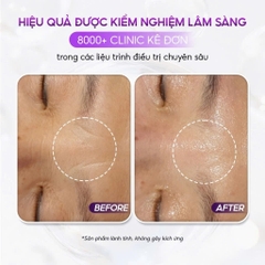 CONAPIDIL CEMENZAL LIGHT: Kem Dưỡng Tái Tạo Da, Hỗ Trợ Nâng Cơ & Cải Thiện Sẹo Rỗ