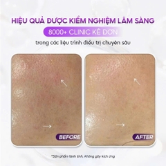 CONAPIDIL CEMENZAL LIGHT: Kem Dưỡng Tái Tạo Da, Hỗ Trợ Nâng Cơ & Cải Thiện Sẹo Rỗ