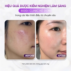 VQM Phytocin Hybrid Cream : Kem Dưỡng Ẩm & Phục Hồi Da Chuyên Sâu, Cải Thiện Mụn & Kích Ứng