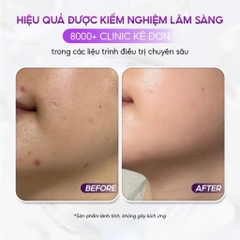 VQM Phytocin Hybrid Cream : Kem Dưỡng Ẩm & Phục Hồi Da Chuyên Sâu, Cải Thiện Mụn & Kích Ứng
