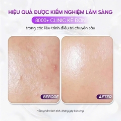 VQM Phytocin Hybrid Cream : Kem Dưỡng Ẩm & Phục Hồi Da Chuyên Sâu, Cải Thiện Mụn & Kích Ứng