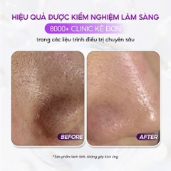 aXENDA ROUTINER: Sáp Peel Da Sinh Học - Tái Tạo & Phục Hồi Làn Da Ngay Trong Giấc Ngủ