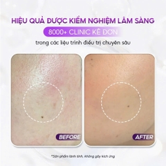 CONAPIDIL LOTION POLISHING: Dầu Rửa Mặt Sạch Sâu & Kháng Khuẩn, Dịu Nhẹ Cho Mọi Làn Da