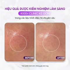 CONAPIDIL CEMENPHALT: Mặt Nạ Thạch Phục Hồi, Giúp Làn Da Nhạy Cảm Trở Nên Khỏe Mạnh