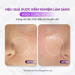 CONAPIDIL CEMENSHEET: Mặt Nạ Thải Độc & Phục Hồi - Cho Làn Da Khỏe Mạnh & Tươi Sáng