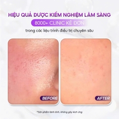 CONAPIDIL FINISH LOTION SPF50+/PA+++: Kem Chống Nắng Chuyên Biệt Cho Làn Da Nhạy Cảm