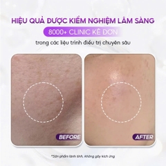 CONAPIDIL FINISH LOTION SPF50+/PA+++: Kem Chống Nắng Chuyên Biệt Cho Làn Da Nhạy Cảm