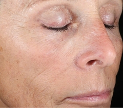 IS CLINICAL ACTIVE PEEL SYSTEM: Bộ Đôi Tái Tạo Da Chuyên Sâu, Cho Làn Da Căng Bóng & Mịn Màng