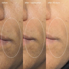 DERMALOGICA LIQUID PEELFOLIANT: Peel Hàng Ngày - Giảm Nếp Nhăn, Sáng Da & Se Khít Lỗ Chân Lông