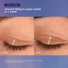 DERMALOGICA PHYTO NATURE LIFTING EYE CREAM: Kem Mắt Nâng Cơ & Săn Chắc, Cho Vùng Da Mắt Trẻ Trung