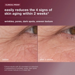 DERMALOGICA DYNAMIC SKIN RETINOL SERUM: Tái Tạo & Cải Thiện Tông Da, Cho Làn Da Trẻ Trung Hoàn Hảo