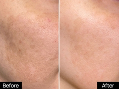 GSC MELA BRIGHT NIGHT SERUM: Tinh Chất Phục Hồi & Dưỡng Sáng, Mờ Nám Chuyên Sâu Ban Đêm