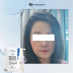 XỊT MỌC TÓC MINOXIDIL BAILLEUL 5% - Giải Pháp Chuyên Sâu Cho Người Bị Hói Đầu, Giúp giảm rụng tóc và kích thích mọc tóc ( Set 3 lọ )