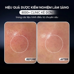 VQM PHYTOCIN (FILM) CREAM: Kem Dưỡng Ẩm Phục Hồi Chuyên Sâu - Kháng Viêm, Giảm Mụn & Tái Tạo Da