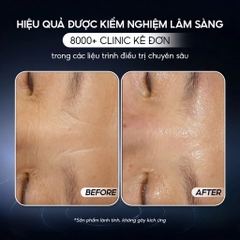 CONAPIDIL CEMENZAL LIGHT (tube) : Kem Dưỡng Hỗ Trợ Tái Tạo & Làm Đầy Sẹo Rỗ - Phục Hồi Chuyên Sâu Từ Tế Bào Gốc