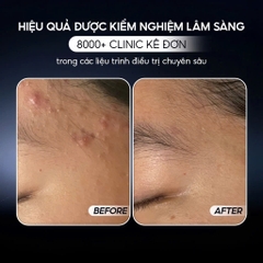 CONAPIDIL SUPERJECTION FIXCICA GEL: Gel Chuyên Biệt Giảm Mụn, Ngừa Thâm Sẹo & Phục Hồi Da Sau Trị Liệu