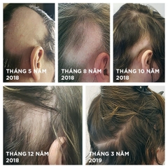 NOURKRIN HAIR GROWTH + IN CLINIC / VIÊN UỐNG MỌC TÓC