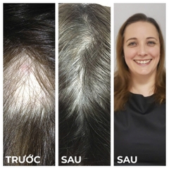 NOURKRIN HAIR GROWTH + IN CLINIC / VIÊN UỐNG MỌC TÓC