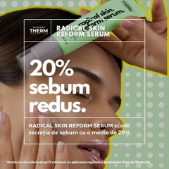 Synergy Therm Radical Skin Reform Serum: Tinh Chất Kiềm Dầu, Trẻ Hóa Và Se Khít Lỗ Chân Lông