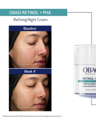 Obagi Medical Retinol + PHA Refining Night Cream: Kem Dưỡng Tái Tạo Da Chuyên Sâu, Làm Mịn Và Đều Màu Da Ban Đêm